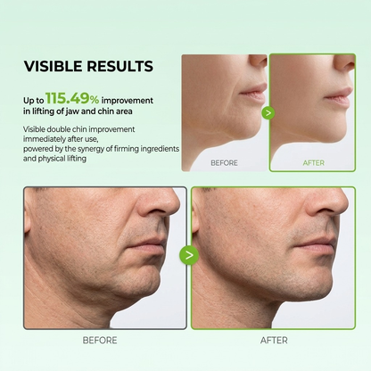 Slimoly Cactox V-Lifting Band